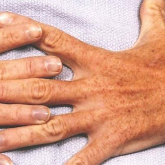 a close up of a hand